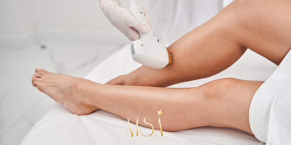 Maltepe Buz Lazer Epilasyon