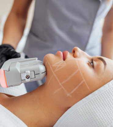 Hifu Ameliyatsız Yüz Germe